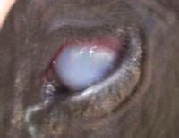 Corneal opacity